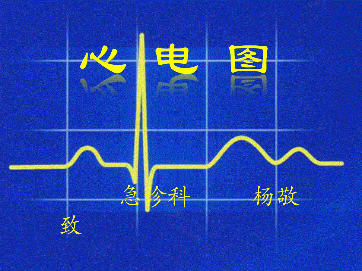 常见心电图心电图